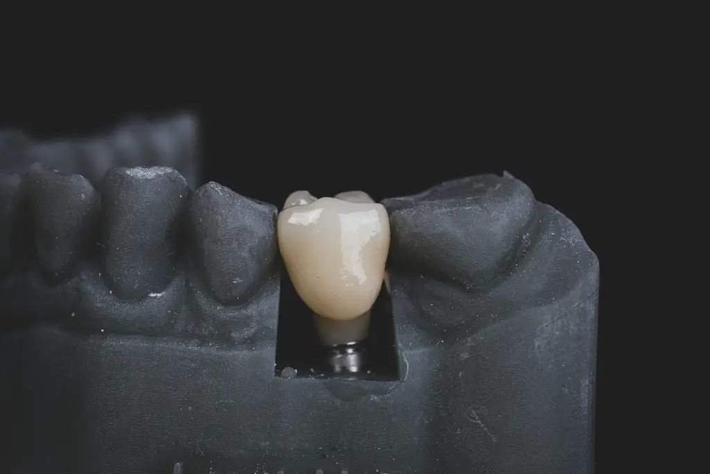 Single crown on an implant in a dark dental model
